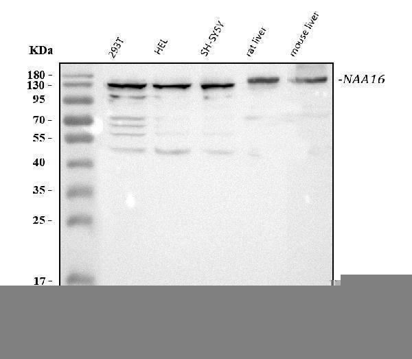 Anti-NARG1L/NAA16 Antibody Picoband® Boster Bio