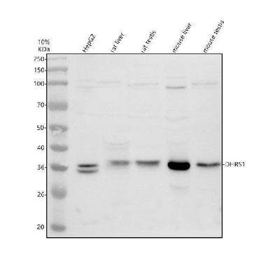 Anti-DHRS1 Antibody Picoband® Boster Bio