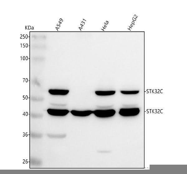 Anti-STK32C Antibody Picoband® Boster Bio