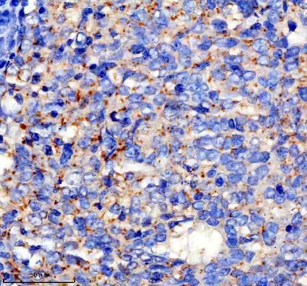 Anti-SPINK9 Antibody Boster Bio