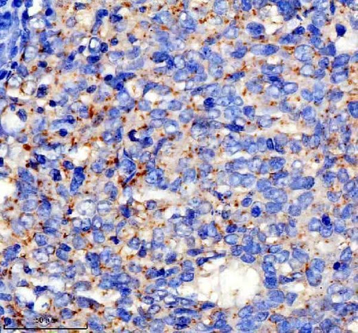Anti-SPINK9 Antibody Boster Bio
