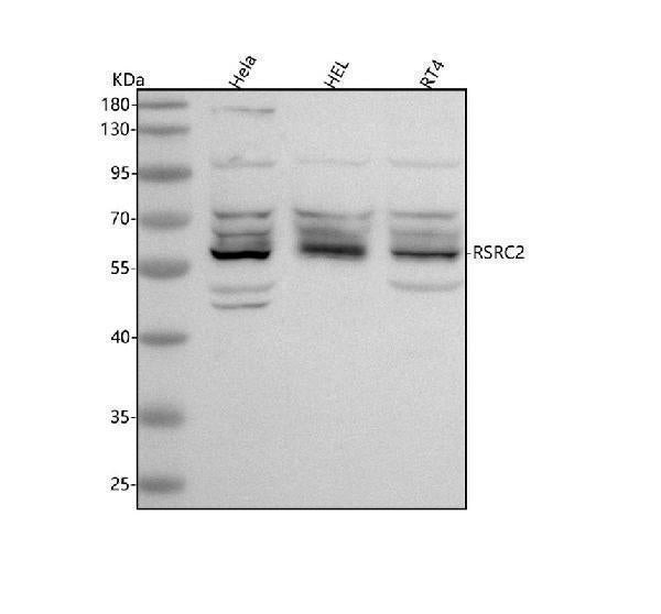 Anti-RSRC2 Antibody Picoband® Boster Bio