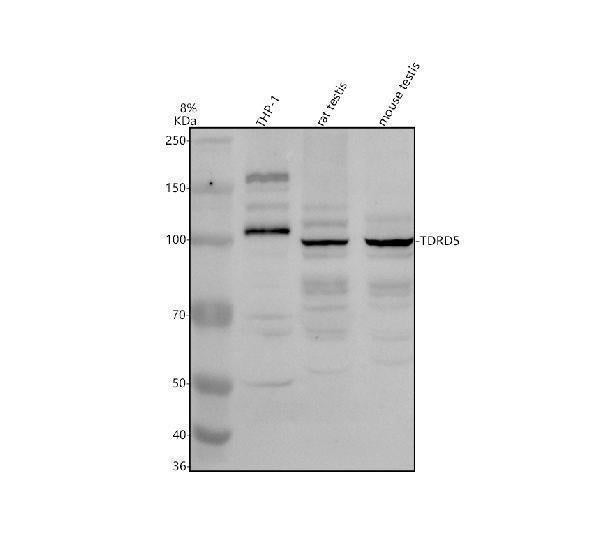 Anti-TDRD5 Antibody Picoband® Boster Bio