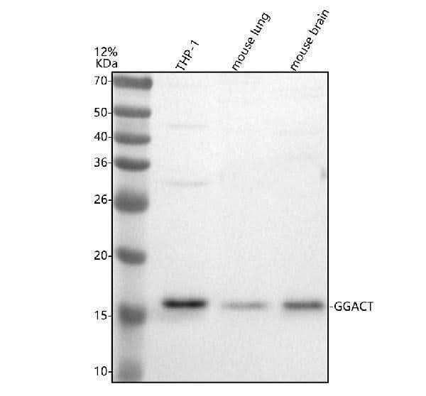 Anti-A2LD1/GGACT Antibody Picoband® Boster Bio