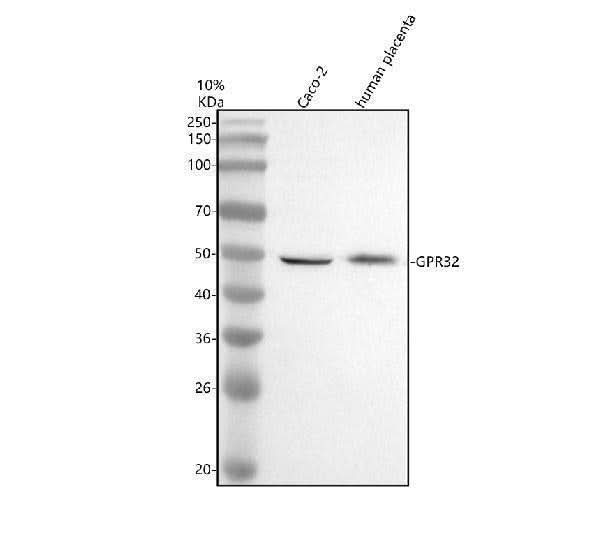 Anti-GPR32 Antibody Picoband® Boster Bio