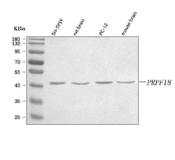 Anti-PRPF18 Antibody Picoband® Boster Bio