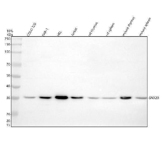 Anti-SNX20 Antibody Picoband® Boster Bio