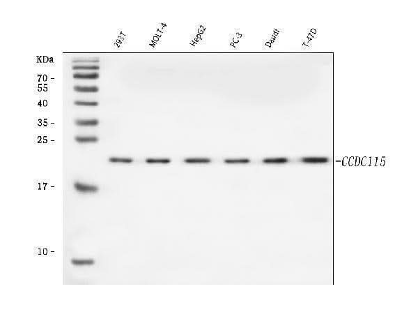 Anti-CCDC115 Antibody Picoband® Boster Bio