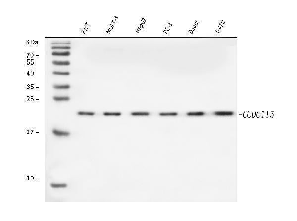 Anti-CCDC115 Antibody Picoband® Boster Bio