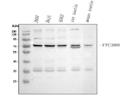 Anti-TTC39B Antibody Picoband® Boster Bio