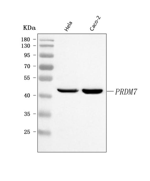 Anti-PRDM7 Antibody Picoband® Boster Bio