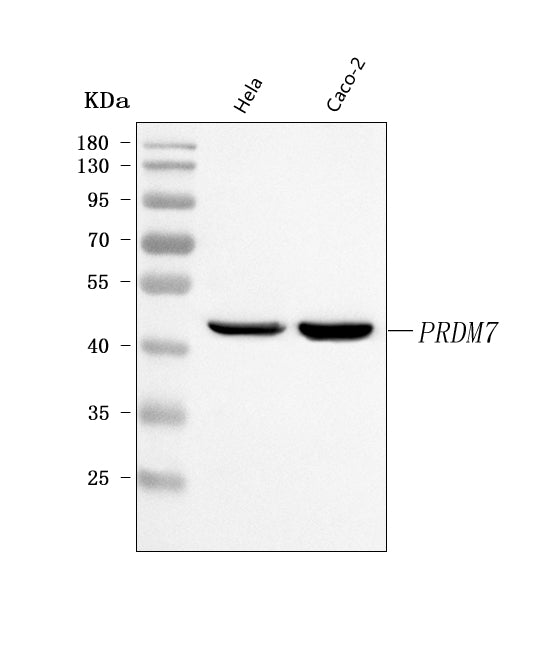 Anti-PRDM7 Antibody Picoband® Boster Bio