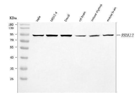 Anti-SWAN/RBM12 Antibody Picoband® Boster Bio