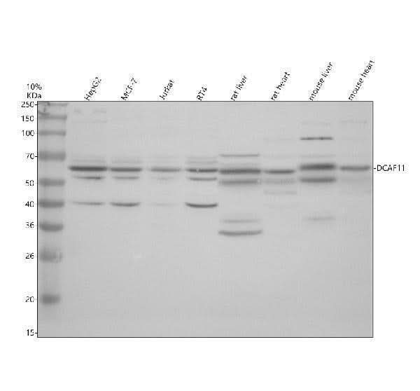 Anti-DCAF11 Antibody Picoband® Boster Bio