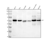 Anti-UBR7 Antibody Picoband® Boster Bio