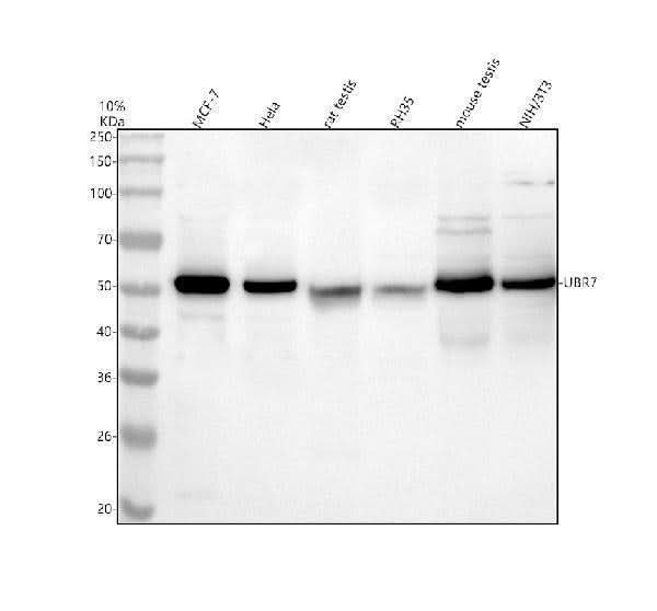 Anti-UBR7 Antibody Picoband® Boster Bio