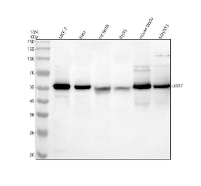 Anti-UBR7 Antibody Picoband® Boster Bio