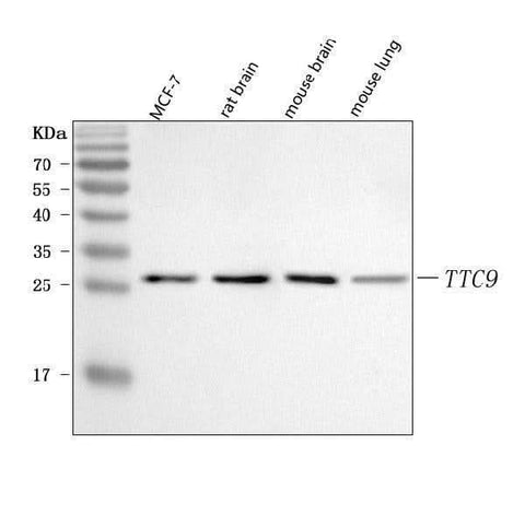 Anti-TTC9 Antibody Picoband® Boster Bio