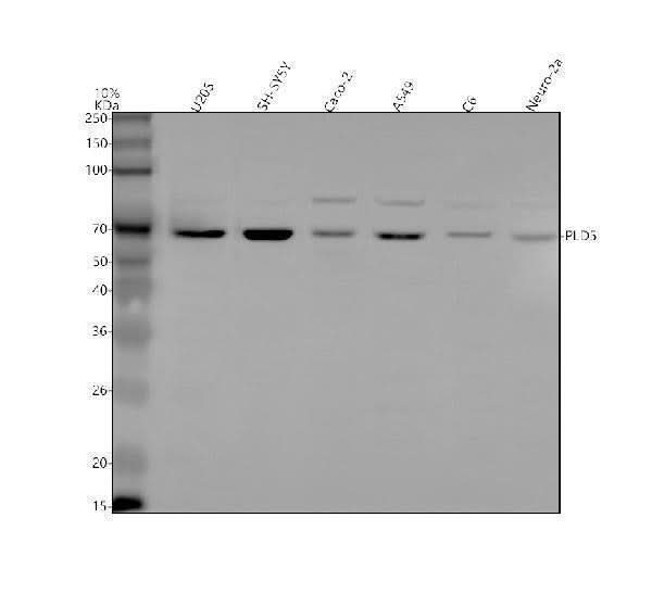 Anti-PLD5 Antibody Picoband® Boster Bio