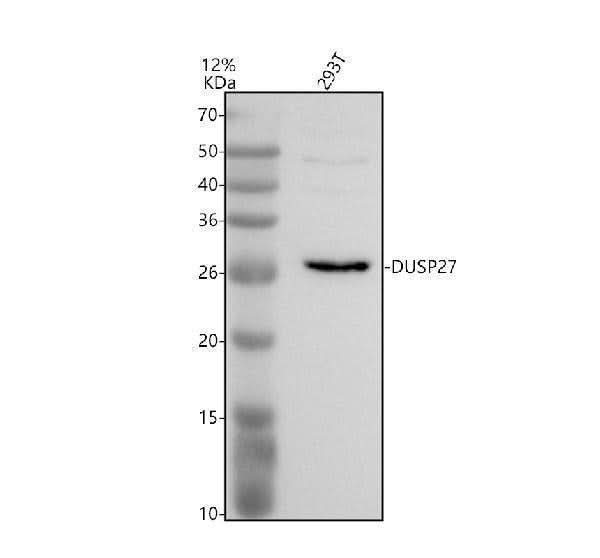 Anti-STYXL2 Antibody Picoband® Boster Bio