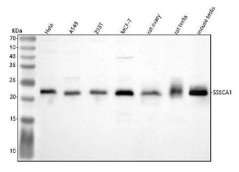 Anti-SSSCA1/ZNRD2 Antibody Picoband® Boster Bio