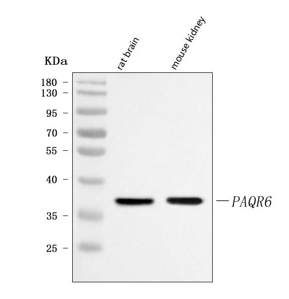 Anti-PAQR6 Antibody Picoband® Boster Bio