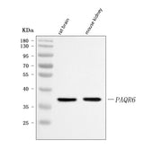 Anti-PAQR6 Antibody Picoband® Boster Bio