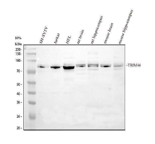 Anti-TRIM46 Antibody Picoband® Boster Bio