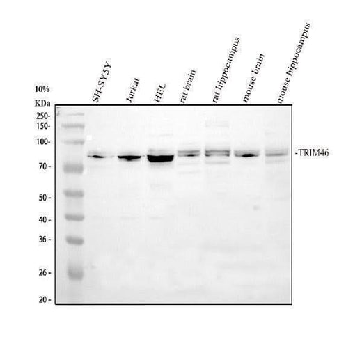 Anti-TRIM46 Antibody Picoband® Boster Bio