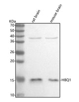 Anti-HBQ1 Antibody Picoband® Boster Bio