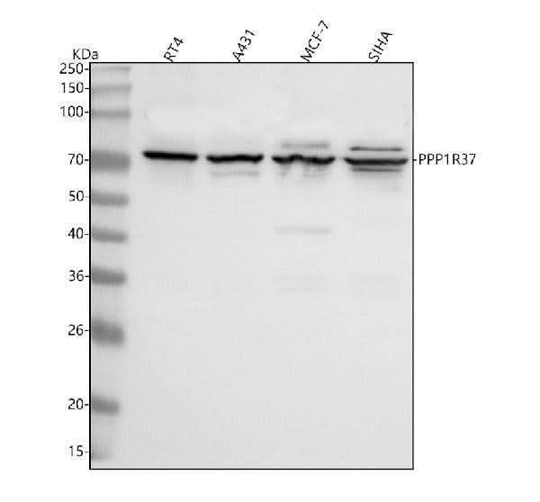 Anti-PPP1R37 Antibody Picoband® Boster Bio