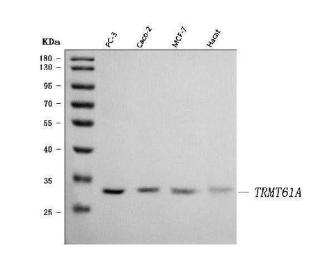 Anti-TRMT61A Antibody Picoband® Boster Bio