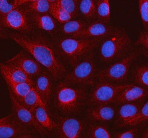 Anti-SLC37A3 Antibody Picoband® Boster Bio