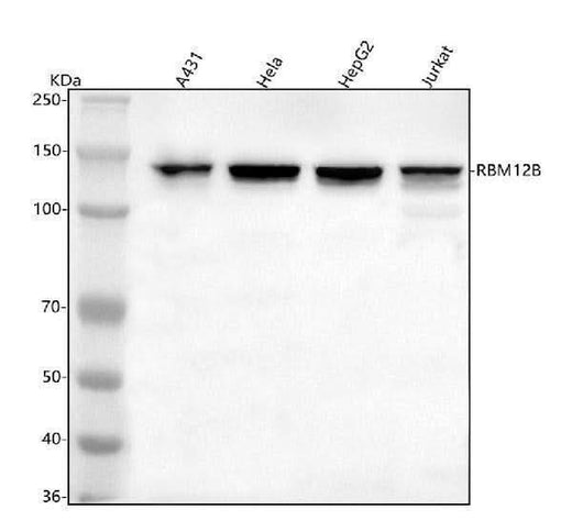 Anti-RBM12B Antibody Picoband® Boster Bio