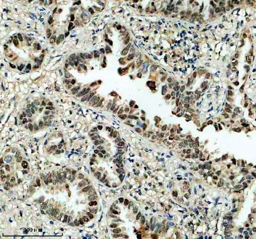 Anti-DEXI Antibody Boster Bio