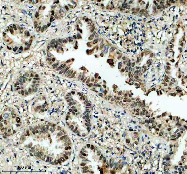 Anti-DEXI Antibody Boster Bio