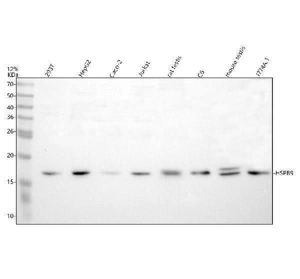 Anti-HSPB9 Antibody Picoband® Boster Bio