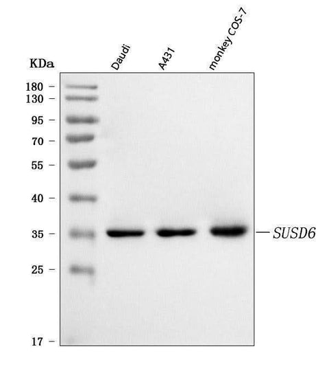 Anti-SUSD6 Antibody Picoband® Boster Bio