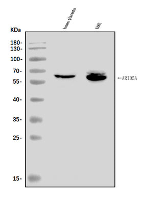 Anti-ARID5A Antibody Picoband® Boster Bio