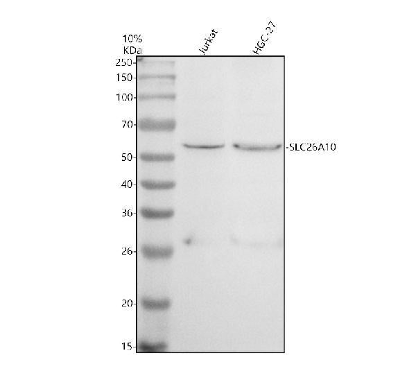 Anti-SLC26A10P Antibody Picoband® Boster Bio
