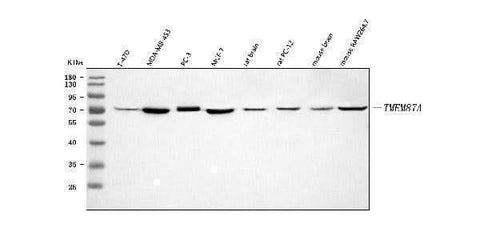 Anti-TMEM87A Antibody Picoband® Boster Bio