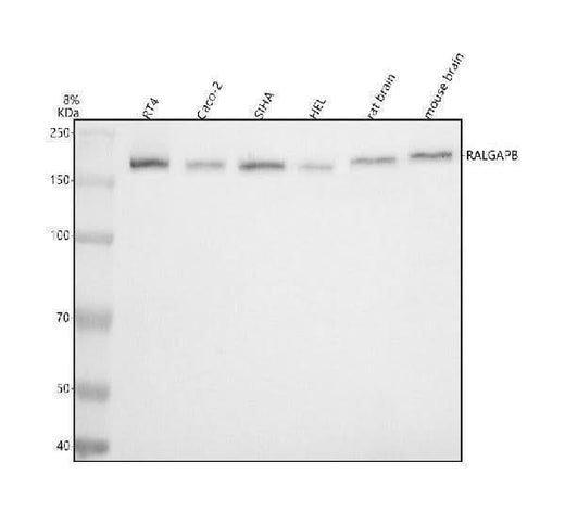 Anti-RALGAPB Antibody Picoband® Boster Bio