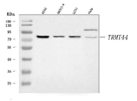 Anti-TRMT44 Antibody Picoband® Boster Bio