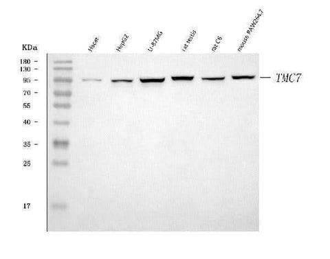 Anti-TMC7 Antibody Picoband® Boster Bio