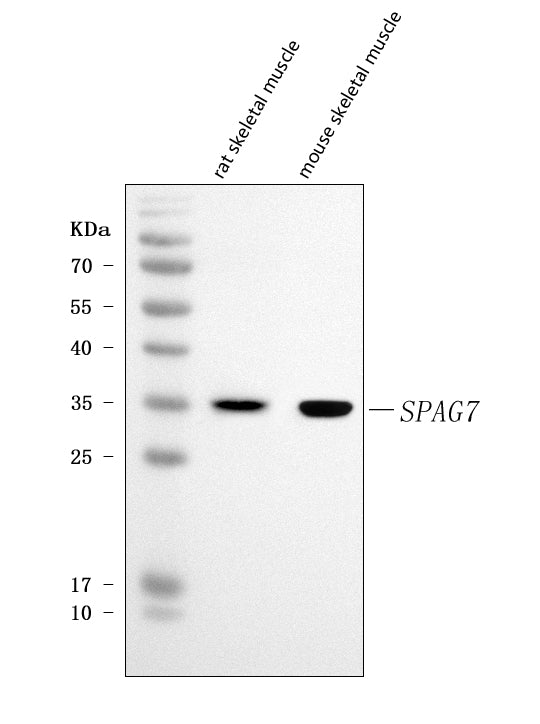Anti-SPAG7 Antibody Picoband® Boster Bio