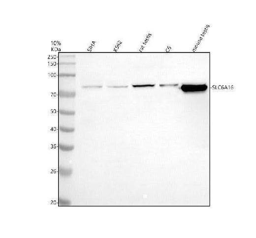 Anti-SLC6A16 Antibody Picoband® Boster Bio