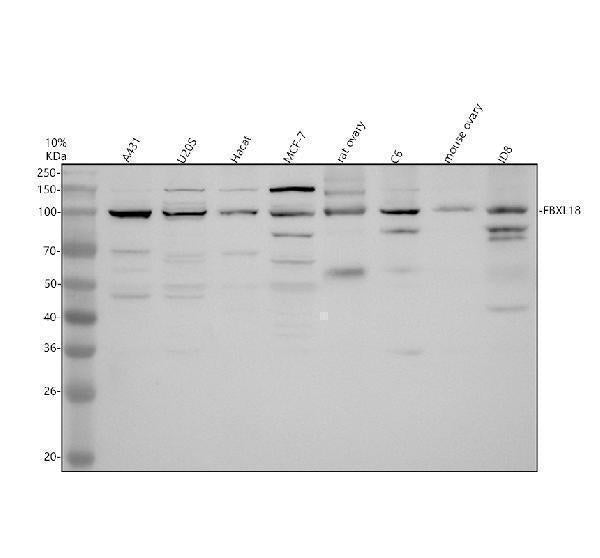 Anti-FBXL18 Antibody Picoband® Boster Bio