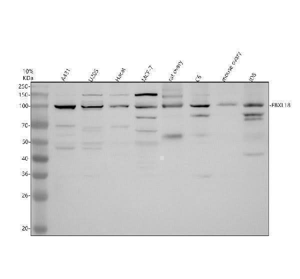 Anti-FBXL18 Antibody Picoband® Boster Bio