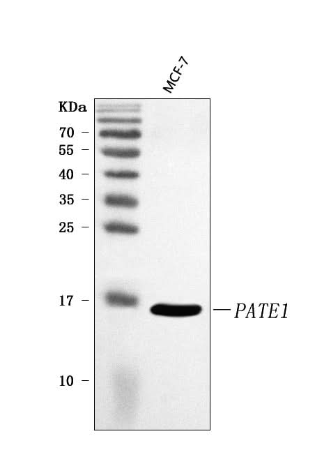 Anti-PATE1 Antibody Picoband® Boster Bio