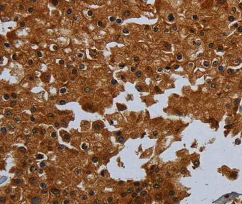 Anti-Human/Mouse ENTPD7 Antibody
